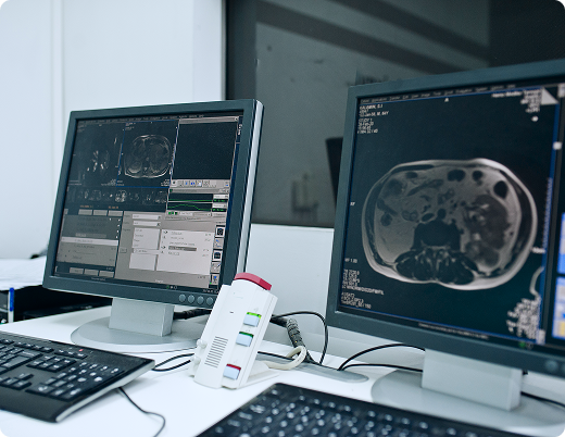 Computers displaying MRI brain scans sit on a table inside an MRI scanning room at a diagnostic imaging center in Texas