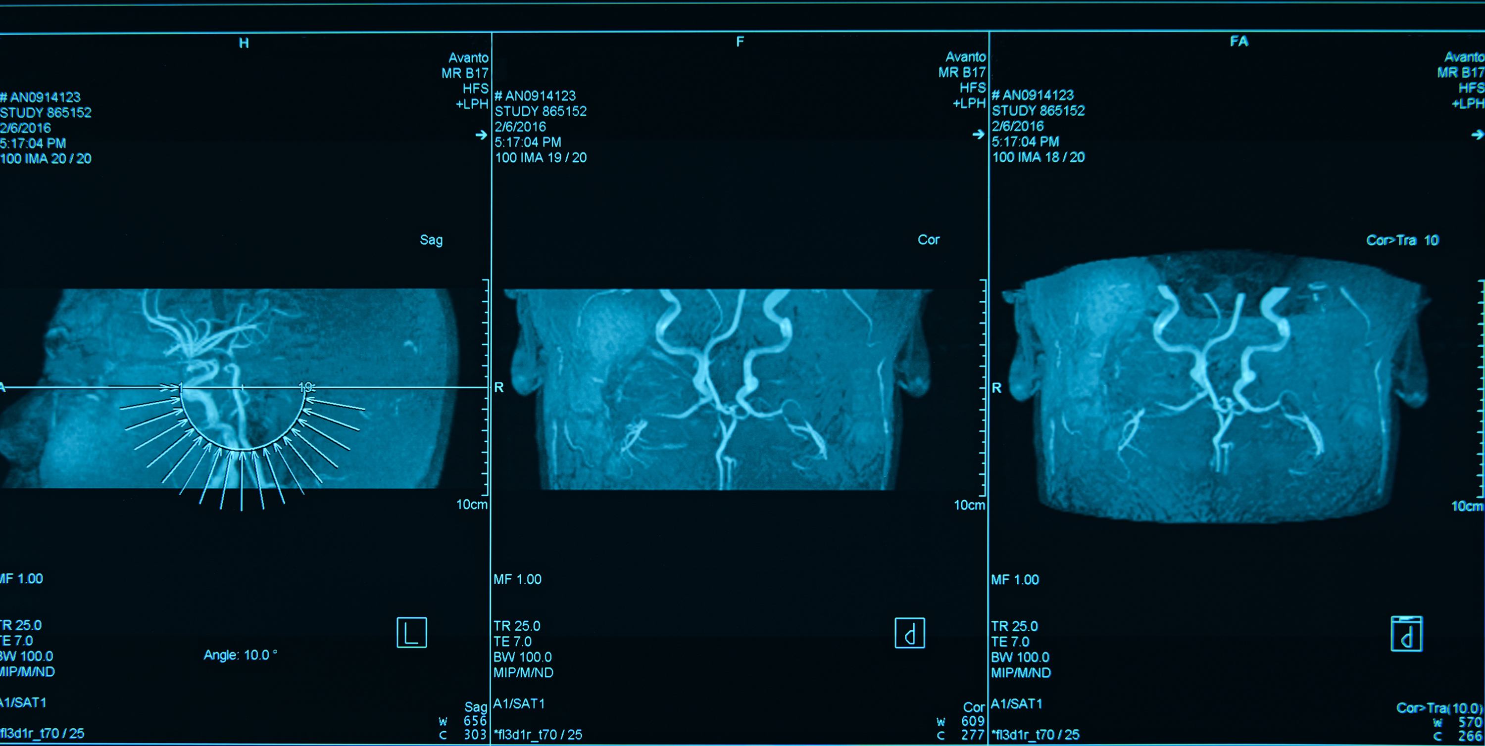 Advanced Nuclear Medicine Scans